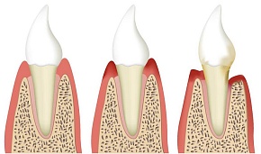 Японские зубы и объем гиппокампа